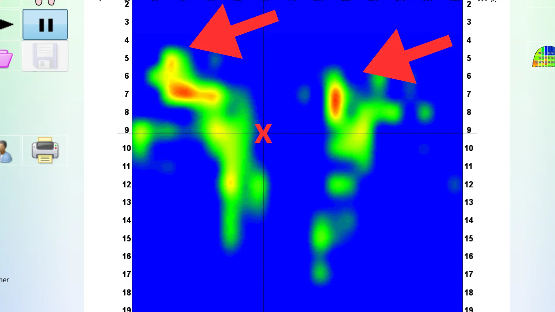 Satteldruckmessung zeigt ungleichmäßige Belastung beim Aufsteigen
